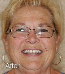 Grace Lumineers after photo.