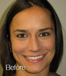 Jaclynn Lumineers before photo.