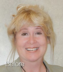 Sue Lumineers before photo.