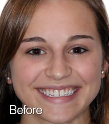 Madison Lumineers before photo.